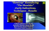 “Hemicap”Resurfacing “The Shoulder” -Early Indications ... · “Hemicap”Resurfacing “The Shoulder”-Early Indications, Techniques , Results Anthony Miniaci MD FRCSC
