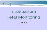 Intra-partum Fetal Monitoring - Amareamare.org.au/wordpress/wp-content/uploads/2016/09/Fetal-Monitoring... · Fetal Monitoring Case 2 . DR – Determine Risk Spontaneous rupture of