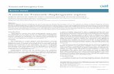 A review on Traumatic diaphragmatic rupture - oatext.com · and inferior vena caval apertures. ... (217) A review on Traumatic diaphragmatic ruptur Trauma Emerg Care, 217 doi: 1.15761TEC.1145