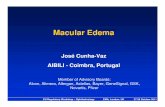 Macular Edema - ema.· Cornea, Cataract & Refractive Surgery Ocular Surface & Inflammation Reading