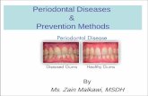 Periodontal Diseases and Prevention of Periodontal Diseases · •Gingival recession •Gingival abscess and cysts. Periodontitis. Periodontitis (Deep Pocket Depth) Periodontal Probes.