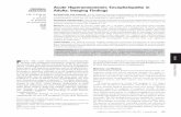 Acute Hyperammonemic Encephalopathy in - AJNR · ORIGINAL RESEARCH Acute Hyperammonemic Encephalopathy in Adults: Imaging Findings J.M. U-King-Im E. Yu E. Bartlett R. Soobrah W. Kucharczyk