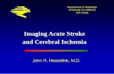 Imaging Acute Stroke and Cerebral Ischemiaspinwarp.ucsd.edu/NeuroWeb/PPT/stroke-acute-45.pdf · Imaging Acute Stroke and Cerebral Ischemia John R. Hesselink, M.D. Department of Radiology