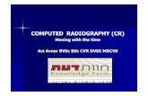 COMPUTED RADIOGRAPHY (CR) - chavatdaat.co.il CR.pdf · Computed radiography. CR 30 -X -Workflow 1 NX Receives DMW (*) from RIS 5 CR 30-X Scans image 4 Identify image ... Processing