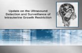 Update on the Ultrasound Detection and Surveillance of ...ncus.org/files/fall2015/strickland.pdf · Update on the Ultrasound Detection and Surveillance of Intrauterine Growth Restriction