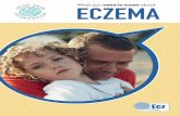What you about ECZEMA ??ve been diagnosed with psoriasis. Now what? What is eczema? Atopic eczema Before