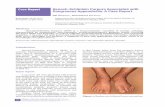 Report Henoch-Schönlein Purpura ... - journal.usm.myjournal.usm.my/journal/mjms-21-2-0721.pdf · Case Report | Appendicitis associated with HSP 73 was performed, and the appendix