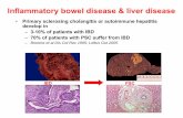 Inflammatory bowel disease & liver disease - Dr. Falk .Inflammatory bowel disease & liver disease
