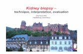 Kidney biopsy - bns-hungary.hu · Complications-1/1090 cases requiring interventional radiology (coil)-3/1090 cases blood transfusion-no persisting hemodynamically relevant av fistules