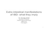 Extra intestinal manifestations of IBD- what they implynams-india.in/downloads/symposium/ibd2014/6. NAMS IBD ExtraIntestinal... · 1 Extra intestinal manifestations of IBD-what they