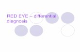 RED EYE – differential diagnosis - Masarykova univerzita · RED EYE – differential diagnosis . RED EYE „Red eye“ is sign of pathology of anterior or posterior ocular segment,
