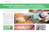 Trauma dentaire : extraction et implantation immédiate · Trauma dentaire : extraction et implantation immédiate Dans une situation de fractures radiculaires, la solution d’une