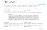 Case report Open Access Ectopic Liver Tissue Attached to ...Case report Open Access Ectopic Liver Tissue Attached to the Gallbladder Wall: a case report Ioannis Triantafyllidis1*,