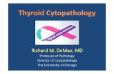 richard demay thyroid - K&M Congresskmcongress.com/eloadasok/iap2011/richard_demay_thyroid.pdf · Nuclear grooves (extensive) Intranuclear Inclusions (even 1) Other: Powdery chromatin,