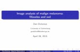 Image analysis of malign melanoma: Waveles and svdmohammad/Mystudents/Dolonius_presentation.pdf · Image analysis of malign melanoma: Waveles and svd Dan Dolonius University of Gothenburg