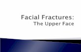 Facial Fracture Basics - West Virginia Universitymedicine.hsc.wvu.edu/media/2064/facialfractures-theupperface.pdf · `Facial Fracture Basics `Nasal Fractures `Naso-orbital-ethmoidal