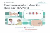 Repair (EVAR) - MUHCv~endovascular-aortic-repair.pdfRepair (EVAR)? Endovascular aortic repair (EVAR) is a way of repairing your aneurysm from inside your artery. Your surgeon will