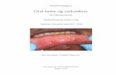 Oral helse og sarkoidose · Det finnes rundt 70 dokumenterte kasus rapporter som knytter sarkoidose til oral sarkoidose i engelskspråklig litteratur. Forskjellige kasus har vist