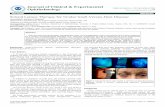 n ic a l & ntal Journal of Clinical & Experimental li pht ......Keratoconjunctivitis sicca Case Report A 57-year-old Caucasian female, presented to the University of ... Schirmer’s