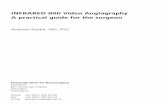 INFRARED 800 Video Angiography A practical guide for the ... · INFRARED 800 Video Angiography A practical guide for the surgeon University Clinic for Neurosurgery Inselspital Bern