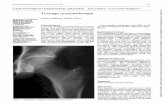 Teenage monoarthralgia - Annals of the Rheumatic …Teenage monoarthralgia Figure3 Sameillustration asfig1.TheMRIexaminationpromptedreviewofthe conventionalradiographwhichwasinitially