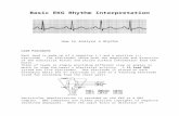  · Web viewBasic EKG Rhythm Interpretation How to Analyze a Rhythm Lead Placement Each lead is made up of a negative (-) and a positive (+) electrode. The electrodes sense both the