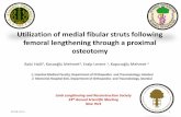 Utilization of medial fibular struts following femoral ...llrs.org/PDFs/Annual Meeting Presentations/Friday Meeting/10.Balci.pdf%35 of the femur •Mean follow up ... •One sequela