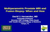 Multiparametric Prostate MRI and Fusion Biopsy- When and How · Multiparametric Prostate MRI and Fusion Biopsy- When and How David J. Hernandez, MD ... •MR Dynamic contrast-enhanced