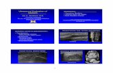 Ultrasound Evaluation of Disclosures: Masses Ultrasound of Masses.pdf1 Ultrasound Evaluation of Masses Jon A. Jacobson, M.D. Professor of Radiology Director, Division of Musculoskeletal