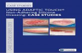USING ADAPTIC TOUCH® Non-Adhering Silicone Dressing: CASE STUDIES · 2013-05-28 · ADAPTIC TOUCH® NON-ADHERING SILICONE DRESSING CASE STUDIES | 3 ADAPTIC TOUCH® Non-Adhering Silicone