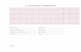 12 lead EKG SAMPLES - cdn.ymaws.com · Answers 1. Normal sinus 14. V F (Torsade’s de points) 2. Normal sinus with inferior MI 15. Second degree AV block wenke bach (mobits 1)