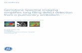 Gemstone Spectral Imaging simplifies lung filling defect ...Gemstone Spectral Imaging provides clinicians the opportunity to gather more information without compromise. In this case,