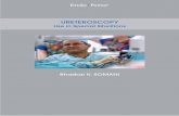URETEROSCOPY - KARL STORZ · 6 Ureteroscopy – Use in Special Situations 1.0 Introduction There has been a rise in the prevalence and incidence of urolithiasis worldwide.14 The lifetime