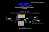 FOCUS ON CHRONIC LYMPHOCYTIC LEUKEMIA 2018.pdf · Chronic lymphocytic leukemia (CLL) is a clonal disorder characterized by the expression of small, mature-appearing, immunologically