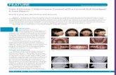 Class II Division 1 Malocclusion Treated with a Cervical ... · I L. 27 N. 1 SPING 2016 25 Abstract: Orthodontic treatment for skeletal Class II malocclusion was undertaken with the