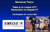 Meniscal Tears: Take it or Leave it?? Resection vs Repair?? · • Partial Meniscectomy WITHOUT an Intact Peripheral Rim or Root Attachment results in Loss of Normal Hoop Stresses