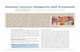 Annular Lesions: Diagnosis and Treatment · Psoriasis is a chronic inflammatory skin condition with a genetic predisposition. Plaque and pustular psoriasis are the ... appear on oral