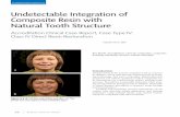 Undetectable Integration of Composite Resin with Natural ...aacd.com/proxy.php?filename=files/Dental Professionals/jCD/Vol.29/issue... · Undetectable integration of composite resin
