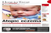 PrOfESSOr rODNEy Atopic eczema - Cirrus 2015/09/11 آ  Atopic eczema can significantly impair the quality