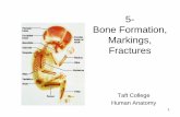 5- Bone Formation, Markings, Fractures - Taft Collegect-prod-media.taftcollege.edu/cjohnson/2250/5_Bone...Endochondral Ossification “within cartilage” • Step 4 – Blood vessels