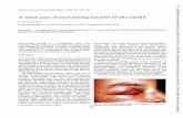 Afatal case of necrotising fasciitis eyelid · BritishJournalofOphthalmology, 1988, 72, 428-431 Afatal caseofnecrotisingfasciitis oftheeyelid R WALTERS FromSouthamptonEyeHospital,