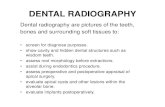 DENTAL RADIOGRAPHY · 2013-08-21 · DENTAL RADIOGRAPHY Dental radiography are pictures of the teeth, bones and surrounding soft tissues to:bones and surrounding soft tissues to: