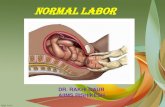 NORMAL LABORaiimsrishikesh.edu.in/newwebsite/wp-content/uploads/2019/... · 2019-02-13 · glucocorticoids, mechanical stretching in late pregnancy, increase in cytokines (IL–1,