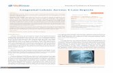 Congenital Colonic Atresia: 4 Case Reports · 2018-06-02 · Atresia of the colon is a rare etiology of the neonatal bowel obstruction. Colonic atresia can be associated with other