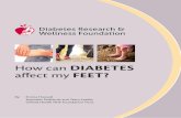 How can DIABETES affect my FEET?...blocked leading to reduced blood supply to the feet. Diabetic neuropathy occurs in people with type 1 and type 2 diabetes and is the commonest cause