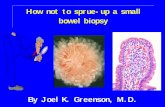 The surgical pathology of How not to sprue-up a small ...€¦ · Tropical Sprue?Chronic malabsorption after infectious diarrhea commonest in tropical regions?Bacterial overgrowth
