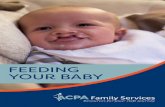 FEEDING YOUR BABY - CleftlineFeeding Your Baby is also available on CD-Rom. Contact the American Cleft Palate-Craniofacial Association at 1.800.24.CLEFT (1-800-242-5338) to request
