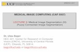 Lecture9-Fuzzy Connectivity Image Segmentation IIIbagci/teaching/mic17/lec9.pdf · LECTURE 9: Medical Image Segmentation (III) (Fuzzy Connected Image Segmentation) Dr. Ulas Bagci
