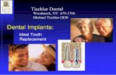 Tischler Dental - Amazon S3s3.amazonaws.com/webgen_einsteinwebsites/public/assets/...Benefits Of Dental Implants 1.Prevents further bone loss through stimulation of bone 2. Increases