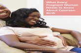 What Every Needs to Know Birth - National …...belly (transverse lie) or the placenta is covering the cervix (placenta previa). In other situations, having a C-section might have